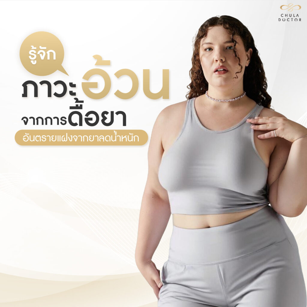 รู้จักภาวะอ้วนจากการดื้อยา อันตรายแฝงจากยาลดน้ำหนัก