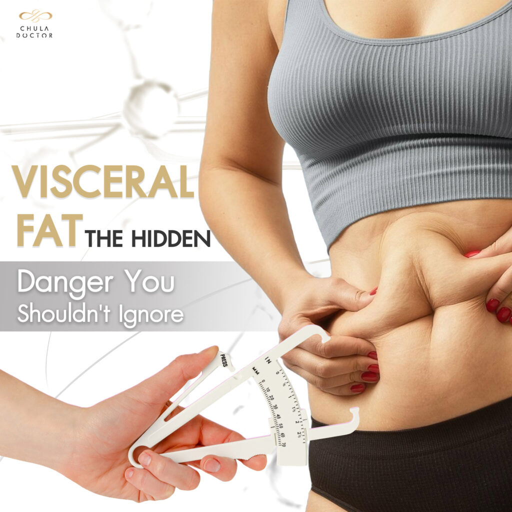 Visceral Fat The Hidden Danger You Shouldn't Ignore