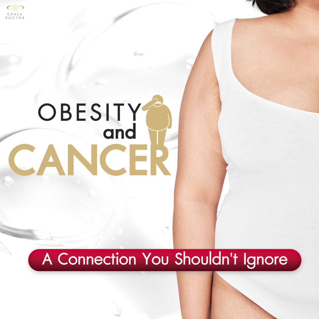 Obesity and Cancer A Connection You Shouldn't Ignore