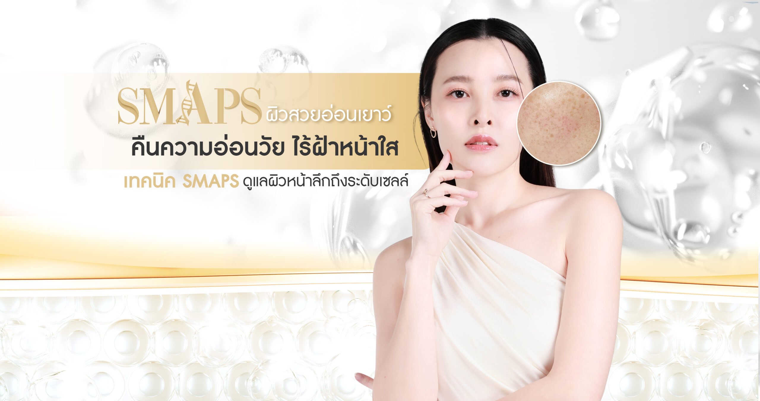 smaps รักษาฝ้า