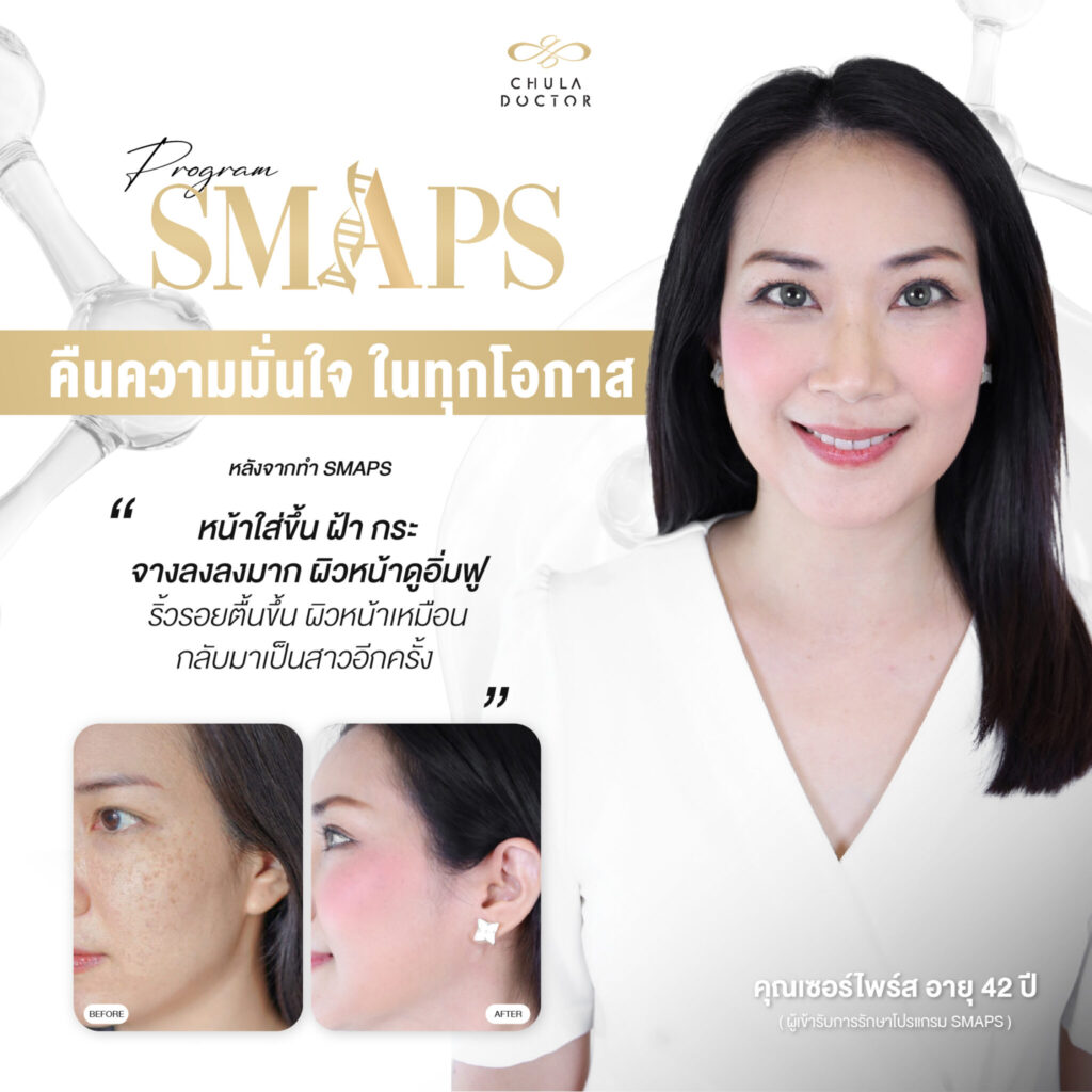 รีวิว รักษาฝ้า 