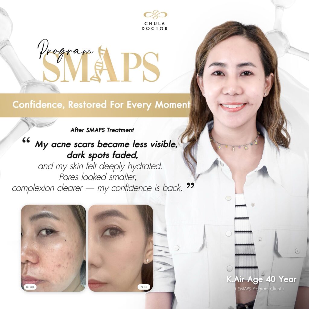 review smaps-2